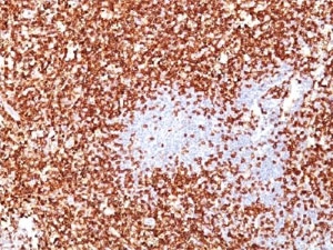 CD45RO Antibody - IHC testing of CD45RO antibody cocktail and FFPE human tonsil.  This image was taken for the unmodified form of this product. Other forms have not been tested.