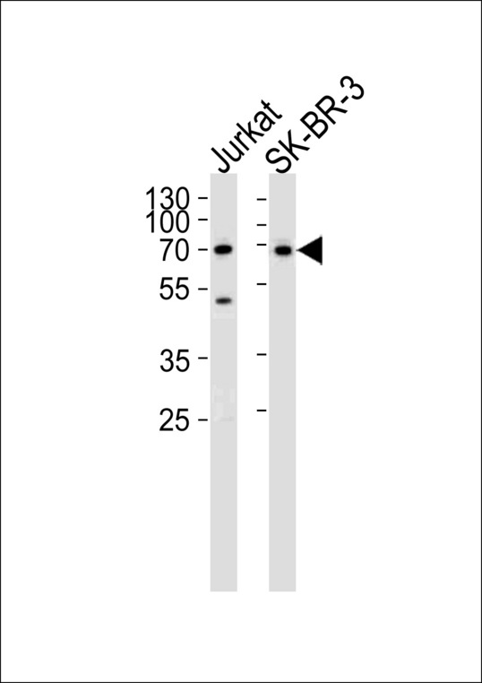 CD46 Antibody - Western blot of lysates from Jurkat,SK-BR-3 cell line (from left to right),using CD46 Antibody. Antibody was diluted at 1:1000 at each lane. A goat anti-rabbit IgG H&L (HRP) at 1:5000 dilution was used as the secondary antibody.Lysates at 35ug per lane.