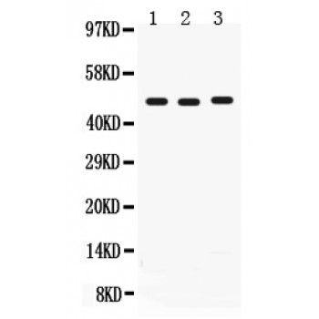 CD46 Antibody - CD46 antibody Western blot. All lanes: Anti CD46 at 0.5 ug/ml. Lane 1: Human Placenta Tissue Lysate at 50 ug. Lane 2: HELA Whole Cell Lysate at 40 ug. Lane 3: COLO320 Whole Cell Lysate at 40 ug. Predicted band size: 49 kD. Observed band size: 49 kD.