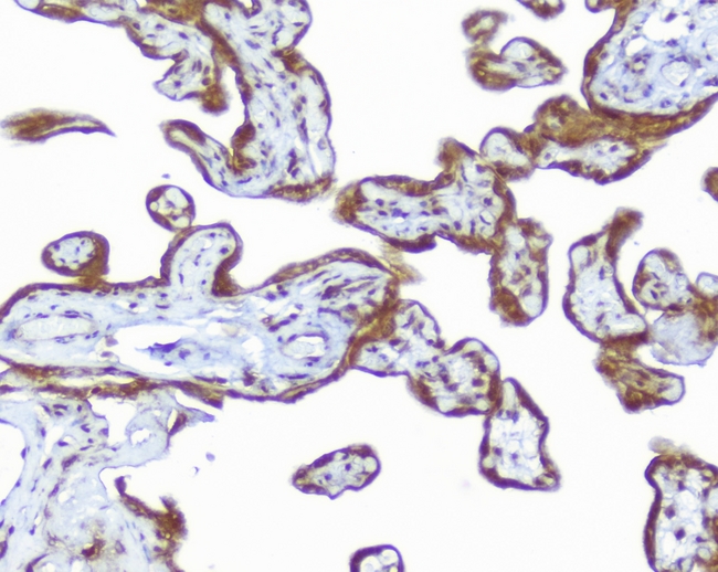 CD46 Antibody - IHC analysis of CD46 using anti-CD46 antibody. CD46 was detected in paraffin-embedded section of human placenta tissues. Heat mediated antigen retrieval was performed in citrate buffer (pH6, epitope retrieval solution) for 20 mins. The tissue section was blocked with 10% goat serum. The tissue section was then incubated with 1µg/ml rabbit anti-CD46 Antibody overnight at 4°C. Biotinylated goat anti-rabbit IgG was used as secondary antibody and incubated for 30 minutes at 37°C. The tissue section was developed using Strepavidin-Biotin-Complex (SABC) with DAB as the chromogen.