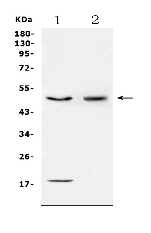 CD46 Antibody - Western blot analysis of CD46 using anti-CD46 antibody. Electrophoresis was performed on a 5-20% SDS-PAGE gel at 70V (Stacking gel) / 90V (Resolving gel) for 2-3 hours. The sample well of each lane was loaded with 50ug of sample under reducing conditions. Lane 1: human HepG2 whole cell lysates, Lane 2: human K562 whole cell lysates. After Electrophoresis, proteins were transferred to a Nitrocellulose membrane at 150mA for 50-90 minutes. Blocked the membrane with 5% Non-fat Milk/ TBS for 1.5 hour at RT. The membrane was incubated with rabbit anti-CD46 antigen affinity purified polyclonal antibody at 0.5 µg/mL overnight at 4°C, then washed with TBS-0.1% Tween 3 times with 5 minutes each and probed with a goat anti-rabbit IgG-HRP secondary antibody at a dilution of 1:10000 for 1.5 hour at RT. The signal is developed using an Enhanced Chemiluminescent detection (ECL) kit with Tanon 5200 system. A specific band was detected for CD46 at approximately 50KD. The expected band size for CD46 is at 44KD.