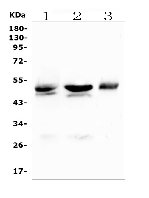 CD46 Antibody - Western blot analysis of CD46 using anti-CD46 antibody. Electrophoresis was performed on a 5-20% SDS-PAGE gel at 70V (Stacking gel) / 90V (Resolving gel) for 2-3 hours. The sample well of each lane was loaded with 50ug of sample under reducing conditions. Lane 1: rat liver tissue lysates, Lane 2: mouse liver tissue lysates, Lane 3: mouse Neuro-2a whole cell lysates. After Electrophoresis, proteins were transferred to a Nitrocellulose membrane at 150mA for 50-90 minutes. Blocked the membrane with 5% Non-fat Milk/ TBS for 1.5 hour at RT. The membrane was incubated with rabbit anti-CD46 antigen affinity purified polyclonal antibody at 0.5 µg/mL overnight at 4°C, then washed with TBS-0.1% Tween 3 times with 5 minutes each and probed with a goat anti-rabbit IgG-HRP secondary antibody at a dilution of 1:10000 for 1.5 hour at RT. The signal is developed using an Enhanced Chemiluminescent detection (ECL) kit with Tanon 5200 system. A specific band was detected for CD46 at approximately 50KD. The expected band size for CD46 is at 44KD.