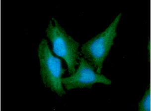 CD46 Antibody - ICC/IF analysis of CD46 in HeLa cells. The cell was stained with CD46 antibody (1:100).The secondary antibody (green) was used Alexa Fluor 488. DAPI was stained the cell nucleus (blue).