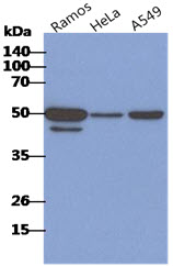 CD46 Antibody - The cell lysates of Ramos, HeLa and A549 (40ug) were resolved by SDS-PAGE, transferred to PVDF membrane and probed with anti-human CD46 antibody (1:1000). Proteins were visualized using a goat anti-mouse secondary antibody conjugated to HRP and an ECL detection system.