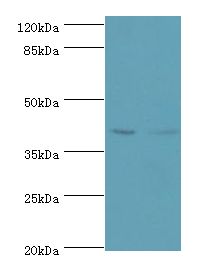 CD46 Antibody - Western blot. All lanes: Membrane cofactor protein antibody at 2 ug/ml. Lane 1: K562 whole cell lysate Lane 2: HeLa whole cell lysate. Secondary antibody: goat polyclonal to rabbit at 1:10000 dilution. Predicted band size: 41 kDa. Observed band size: 41 kDa.  This image was taken for the unconjugated form of this product. Other forms have not been tested.