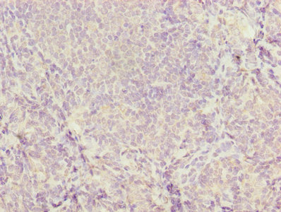 CD46 Antibody - Immunohistochemistry of paraffin-embedded human tonsil tissue using Cd46 Antibody at dilution of 1:100