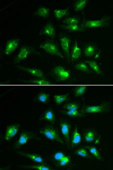 CD46 Antibody - Immunofluorescence analysis of HepG2 cells.