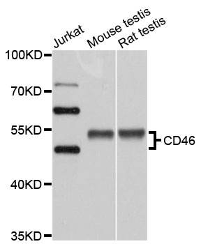 CD46 Antibody - Western blot analysis of extracts of various cell lines, using CD46 antibody at 1:1000 dilution. The secondary antibody used was an HRP Goat Anti-Rabbit IgG (H+L) at 1:10000 dilution. Lysates were loaded 25ug per lane and 3% nonfat dry milk in TBST was used for blocking. An ECL Kit was used for detection and the exposure time was 5s.