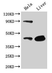 CD46 Antibody - Western blot All lanes: Membrane cofactor protein antibody at 2µg/ml Lane 1: K562 whole cell lysate Lane 2: Hela whole cell lysate Secondary Goat polyclonal to rabbit IgG at 1/10000 dilution Predicted band size: 44, 45, 43, 41, 42, 40, 37 kDa Observed band size: 41 kDa