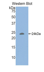 CD47 Antibody - Western blot of recombinant CD47.  This image was taken for the unconjugated form of this product. Other forms have not been tested.