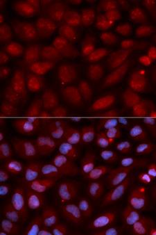 CD47 Antibody - Immunofluorescence analysis of U2OS cells.