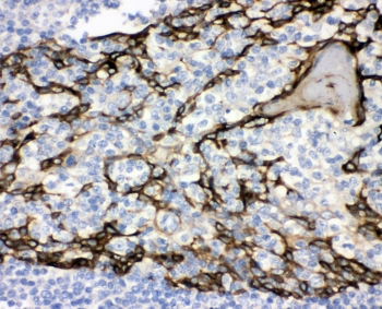 CD47 Antibody - IHC staining of FFPE human tonsil tissue with CD47 antibody at 1ug/ml. HIER: boil tissue sections in pH6, 10mM citrate buffer, for 10-20 min and allow to cool before testing.