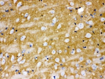 CD47 Antibody - IHC staining of FFPE human mouse brain with CD47 antibody at 1ug/ml. HIER: boil tissue sections in pH6, 10mM citrate buffer, for 10-20 min and allow to cool before testing.