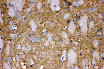 CD47 Antibody - IHC staining of FFPE human rat brain with CD47 antibody at 1ug/ml. HIER: boil tissue sections in pH6, 10mM citrate buffer, for 10-20 min and allow to cool before testing.