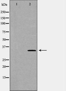 CD47 Antibody - Western blot analysis of mouse lung lysate using CD47 antibody. The lane on the left is treated with the antigen-specific peptide.