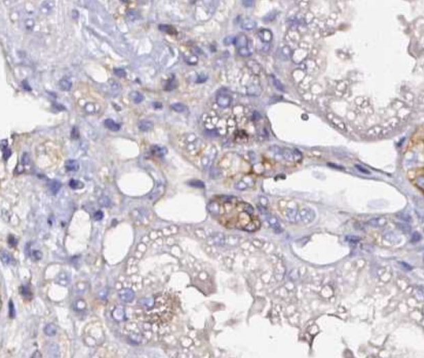 CD47 Antibody - CD47 antibody for IHC in human kidney
