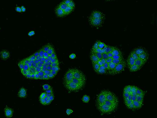 CD47 Antibody - Immunofluorescence staining of CD47 in MCF7 cells. Cells were fixed with 4% PFA, permeabilzed with 0.1% Triton X-100 in PBS, blocked with 10% serum, and incubated with rabbit anti-Human CD47 polyclonal antibody (dilution ratio 1:1000) at 4°C overnight. Then cells were stained with the Alexa Fluor 488-conjugated Goat Anti-rabbit IgG secondary antibody (green) and counterstained with DAPI (blue). Positive staining was localized to Cytoplasm.