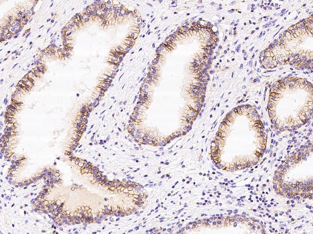 CD47 Antibody - Immunochemical staining CD47 in human prostate with rabbit polyclonal antibody at 1:1000 dilution, formalin-fixed paraffin embedded sections.