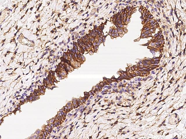 CD47 Antibody - Immunochemical staining CD47 in human urinary bladder with rabbit polyclonal antibody at 1:1000 dilution, formalin-fixed paraffin embedded sections.