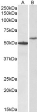 CD47 Antibody - Goat anti-CD47 Antibody (0.3µg/ml) staining of Human Hippocampus (A) and HeLa (B) lysates (35µg protein in RIPA buffer). Primary incubation was 1 hour. Detected by chemiluminescencence.