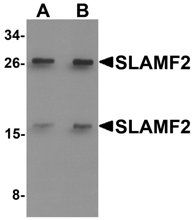CD48 Antibody - Western blot analysis of SLAMF2 in rat lung tissue lysate with SLAMF2 antibody at (A) 1 and (B) 2 ug/ml.