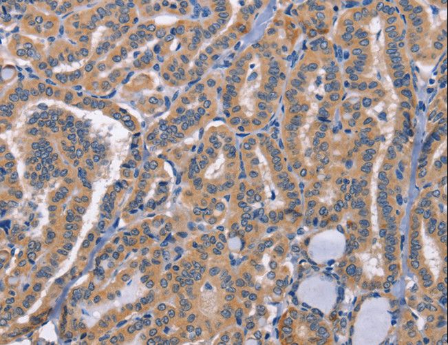 Anti-CD48 Antibody | Rabbit Anti-Human Polyclonal ELISA,IHC,WB | LSBio