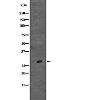 CD48 Antibody - Western blot analysis of CD48 expression in Jurkat cells lysate. The lane on the left is treated with the antigen-specific peptide.
