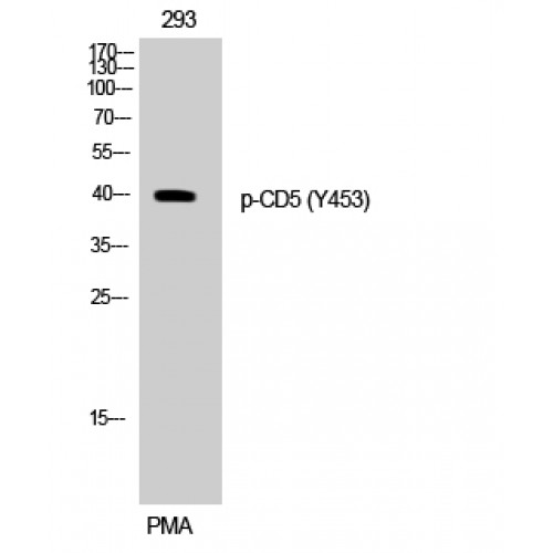CD5 Antibody - Western blot of Phospho-CD5 (Y453) antibody