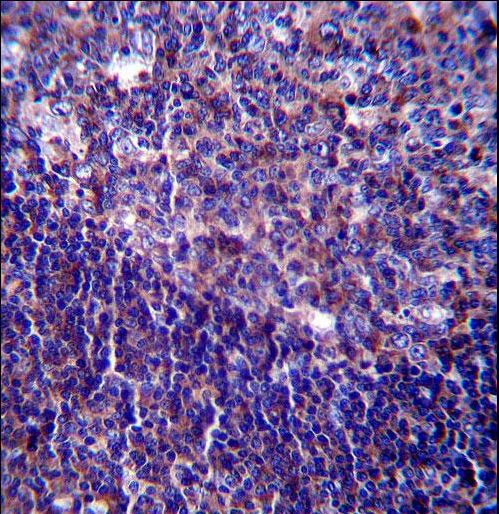 CD5 Antibody - CD5 Antibody immunohistochemistry of formalin-fixed and paraffin-embedded human tonsil tissue followed by peroxidase-conjugated secondary antibody and DAB staining.