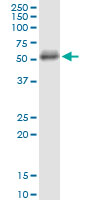 CD5 Antibody - CD5 monoclonal antibody (M01), clone 2F7. Western Blot analysis of CD5 expression in K-562.