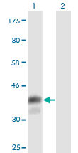 CD5 Antibody - Western Blot analysis of CD5 expression in transfected 293T cell line by CD5 monoclonal antibody (M01), clone 2F7.Lane 1: CD5 transfected lysate (Predicted MW: 36.3 KDa).Lane 2: Non-transfected lysate.