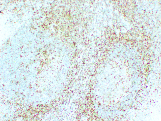 CD5 Antibody - Tonsil 1