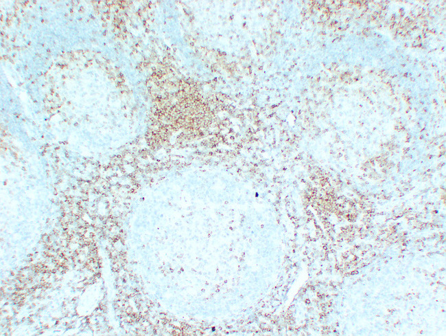 CD5 Antibody - Tonsil 2