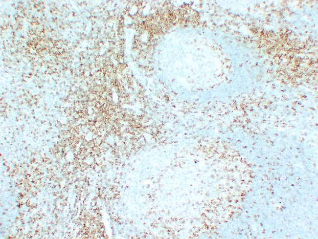 CD5 Antibody - Tonsil 3