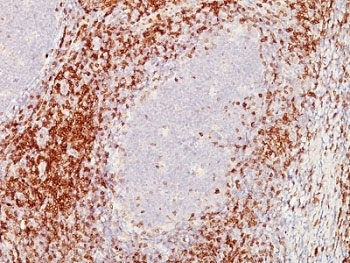 CD5 Antibody - Formalin-fixed, paraffin-embedded human tonsil stained with CD5 antibody (C5/473 + CD5/54/F6).  This image was taken for the unmodified form of this product. Other forms have not been tested.