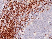 CD5 Antibody - CD5 antibody immunohistochemistry.  This image was taken for the unmodified form of this product. Other forms have not been tested.