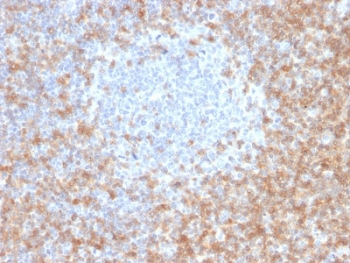 CD5 Antibody - IHC staining of FFPE human tonsil with CD5 antibody (clone CD5/2416). Required HIER: boil tissue sections in 10mM citrate buffer, pH 6, for 10-20 min followed by cooling at RT for 20 min.