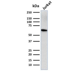 CD5 Antibody - Western blot testing of human Jurkat cell lysate with CD5 antibody (clone CD5/2416). Observed molecular weight: 55~67 kDa depending on glycosylation level.
