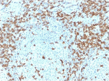 CD5 Antibody - IHC staining of FFPE human tonsil with CD5 antibody (clone CD5/2418). Required HIER: boil tissue sections in 10mM citrate buffer, pH 6, for 10-20 min followed by cooling at RT for 20 min.