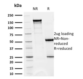 CD5 Antibody - SDS-PAGE analysis of purified, BSA-free CD5 antibody (clone CD5/2418) as confirmation of integrity and purity.