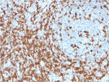 CD5 Antibody - IHC staining of FFPE human tonsil with CD5 antibody (clone CD5/2419). Required HIER: boil tissue sections in 10mM citrate buffer, pH 6, for 10-20 min followed by cooling at RT for 20 min.