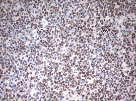 CD5 Antibody - IHC of paraffin-embedded Human lymph node tissue using anti-CD5 mouse monoclonal antibody. (Heat-induced epitope retrieval by 10mM citric buffer, pH6.0, 120°C for 3min).