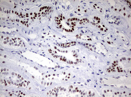 CD5 Antibody - IHC of paraffin-embedded Human Kidney tissue using anti-CD5 mouse monoclonal antibody. (Heat-induced epitope retrieval by 10mM citric buffer, pH6.0, 120°C for 3min).