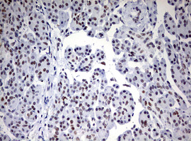 CD5 Antibody - IHC of paraffin-embedded Human pancreas tissue using anti-CD5 mouse monoclonal antibody. (Heat-induced epitope retrieval by 10mM citric buffer, pH6.0, 120°C for 3min).