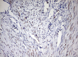 CD5 Antibody - IHC of paraffin-embedded Human endometrium tissue using anti-CD5 mouse monoclonal antibody. (Heat-induced epitope retrieval by 10mM citric buffer, pH6.0, 120°C for 3min).