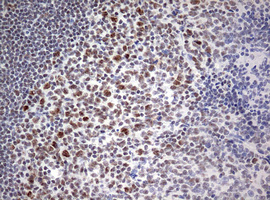 CD5 Antibody - IHC of paraffin-embedded Human tonsil using anti-CD5 mouse monoclonal antibody. (Heat-induced epitope retrieval by 10mM citric buffer, pH6.0, 120°C for 3min).