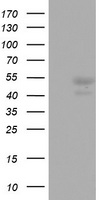 CD5 Antibody - HEK293T cells were transfected with the pCMV6-ENTRY control (Left lane) or pCMV6-ENTRY CD5 (Right lane) cDNA for 48 hrs and lysed. Equivalent amounts of cell lysates (5 ug per lane) were separated by SDS-PAGE and immunoblotted with anti-CD5.