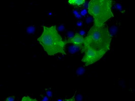 CD5 Antibody - Anti-CD5 mouse monoclonal antibody  immunofluorescent staining of COS7 cells transiently transfected by pCMV6-ENTRY CD5.