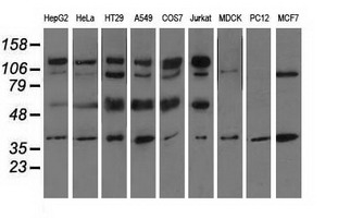 CD5 Antibody - Western blot of extracts (35 ug) from 9 different cell lines by using anti-CD5 monoclonal antibody.