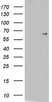 CD5 Antibody - HEK293T cells were transfected with the pCMV6-ENTRY control (Left lane) or pCMV6-ENTRY CD5 (Right lane) cDNA for 48 hrs and lysed. Equivalent amounts of cell lysates (5 ug per lane) were separated by SDS-PAGE and immunoblotted with anti-CD5.